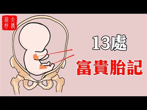 大腿胎記|【大腿有胎記】揭開大腿有胎記的命運密碼，7種胎記位置帶來不。